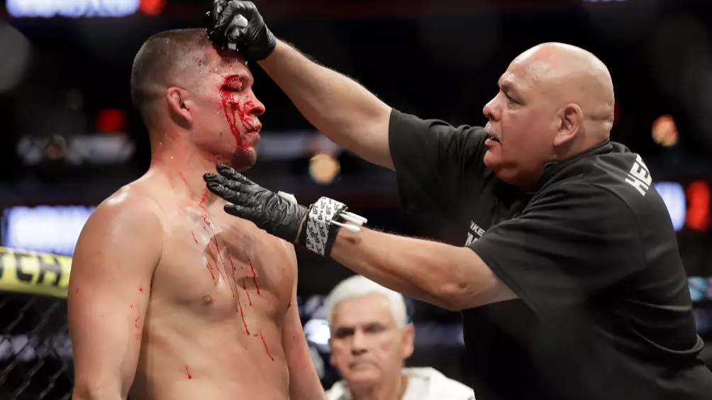 ​Doctor Stops Nate Diaz UFC 244 Fight Due To Injury
