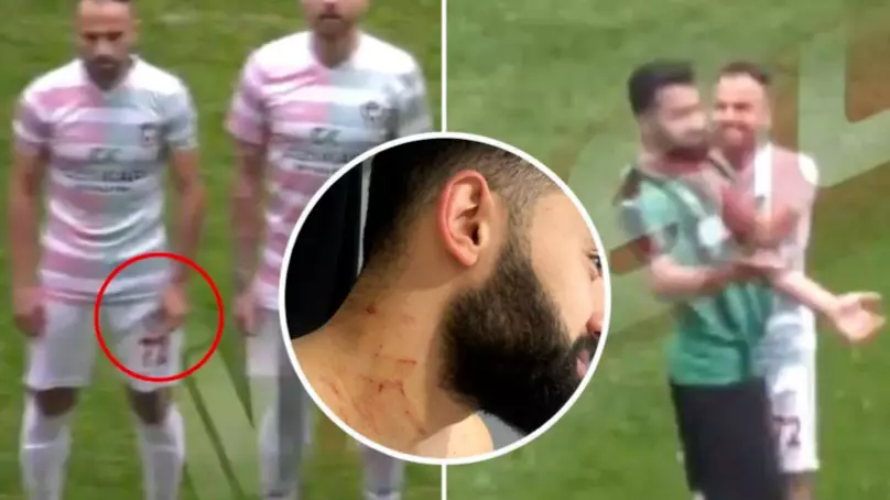 Shocking Footage Shows Footballer Attacked With 'Razor Blade'