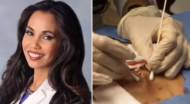 Pimple Pop By Dr. Tess Is Worse Than Anything You've Ever Seen By Dr. Pimple Popper