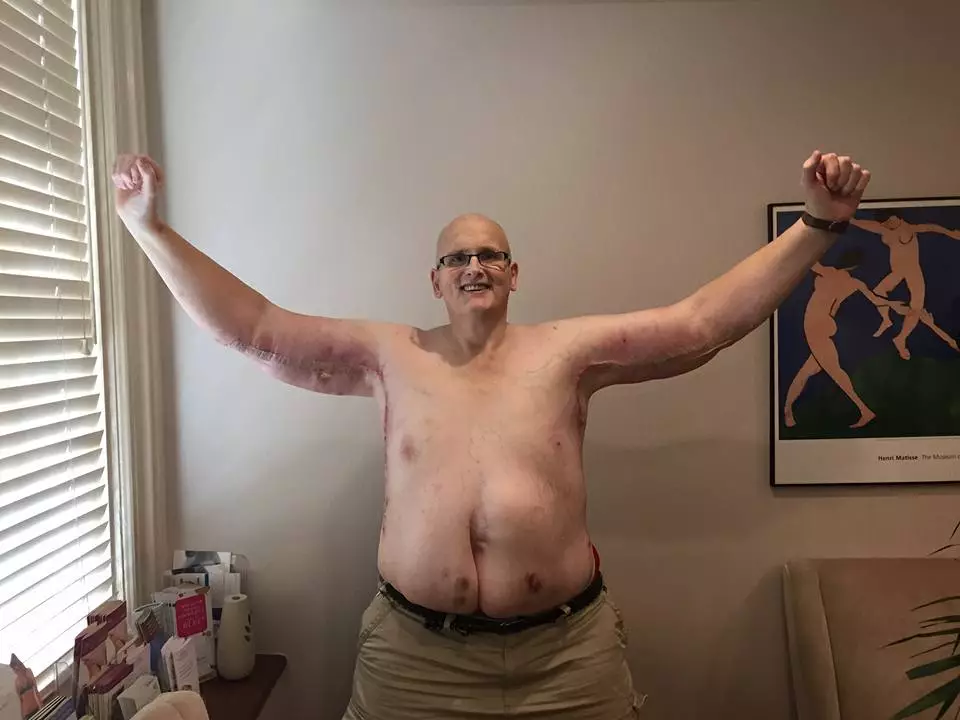 Paul shed an unbelievable 51 stone.
