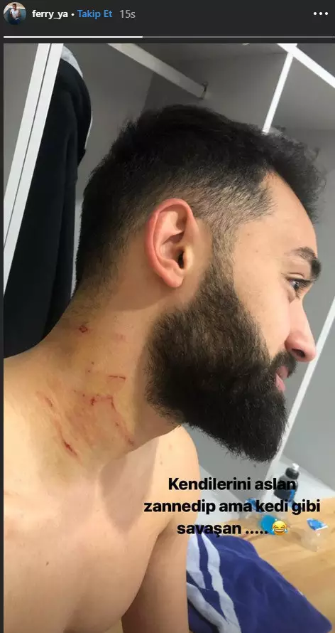 Yazgan shared a photograph of the alleged attack to his Instagram page.
