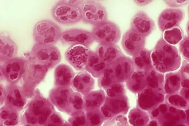 The Biggest Super-Gonorrhoea Hotspots In The UK Have Been Revealed
