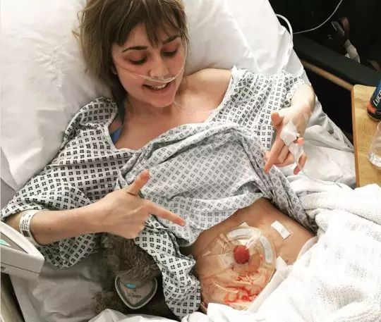 Bethany Gallagher after having her first stoma bag fitted.