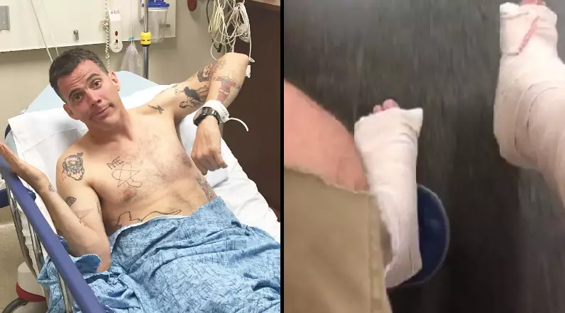 'Jackass' Star Steve-O Has Broken Both His Legs Doing A Stunt