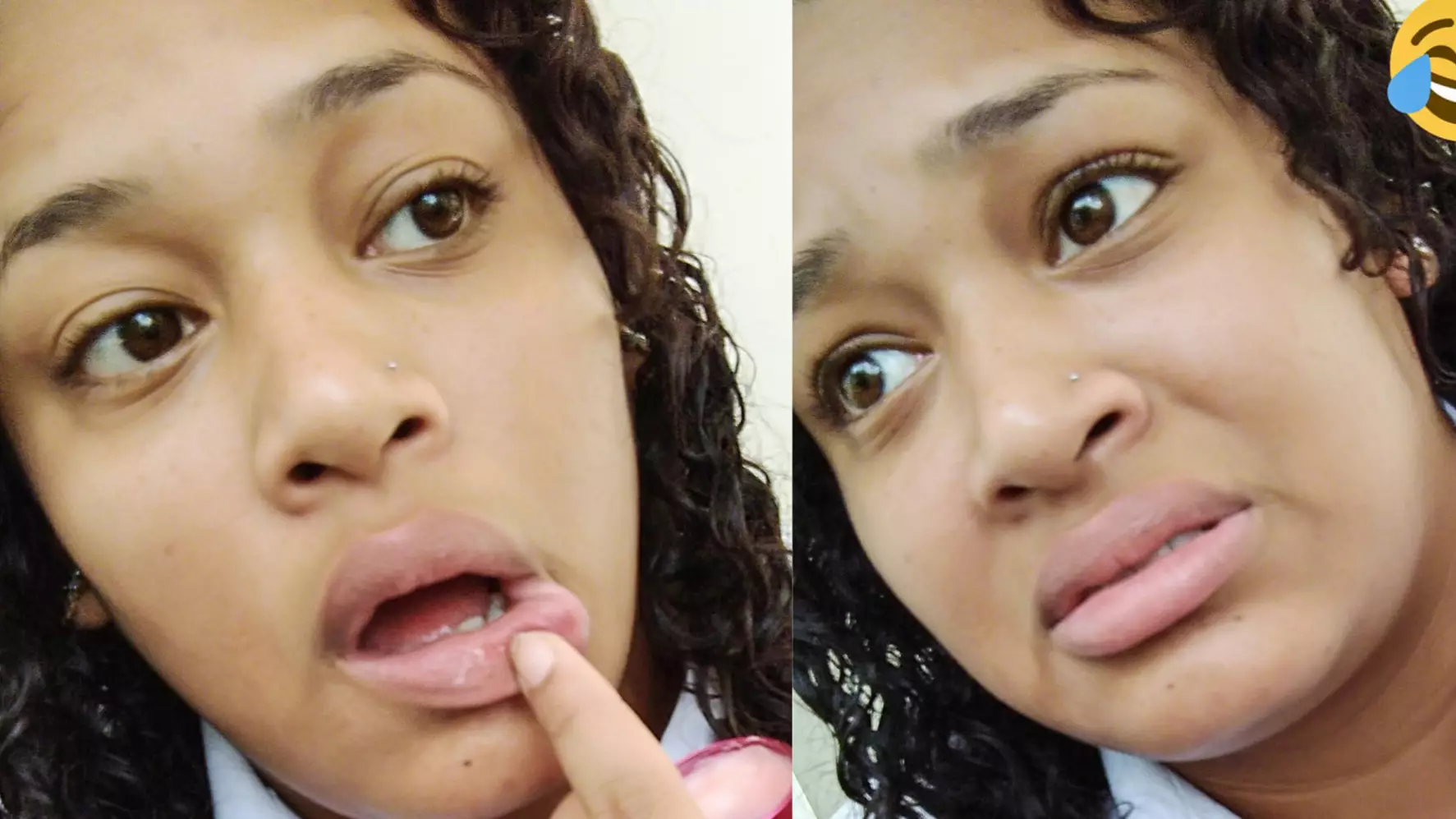 Woman's Reaction After Mistakenly Using Anal Relaxer As Lip Balm Is Hilarious
