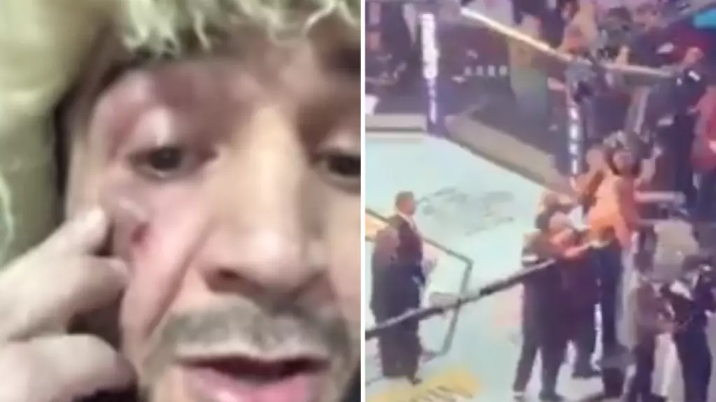 Khabib Nurmagomedov's Cousin Shows Off Injuries From UFC 229 Melee