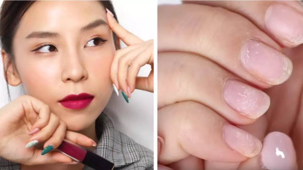 ​YouTuber Shows What Years Of Gel Manicures Have Done To Her Nails
