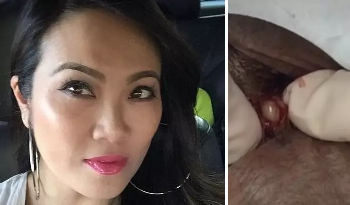 Dr. Pimple Popper Has Celebrated 1 Million YouTube Subscribers The Only Way She Knows How