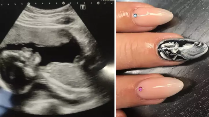 EXCLUSIVE: These Baby Scan Nails Have Gone Viral For All The Right Reasons