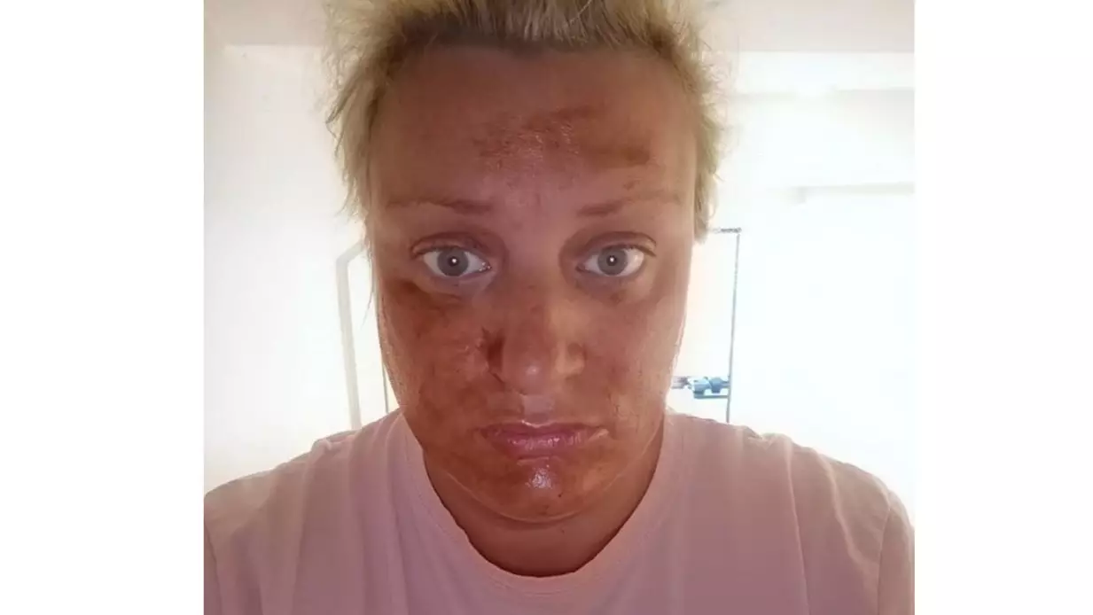 Daisy May Cooper Begs Fans For Help Following Poundland Fake Tan Disaster
