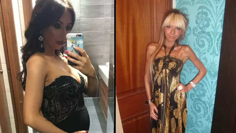 Anorexia Survivor Who Was Told She’d Never Have Children Celebrates Birth Of Second Child 