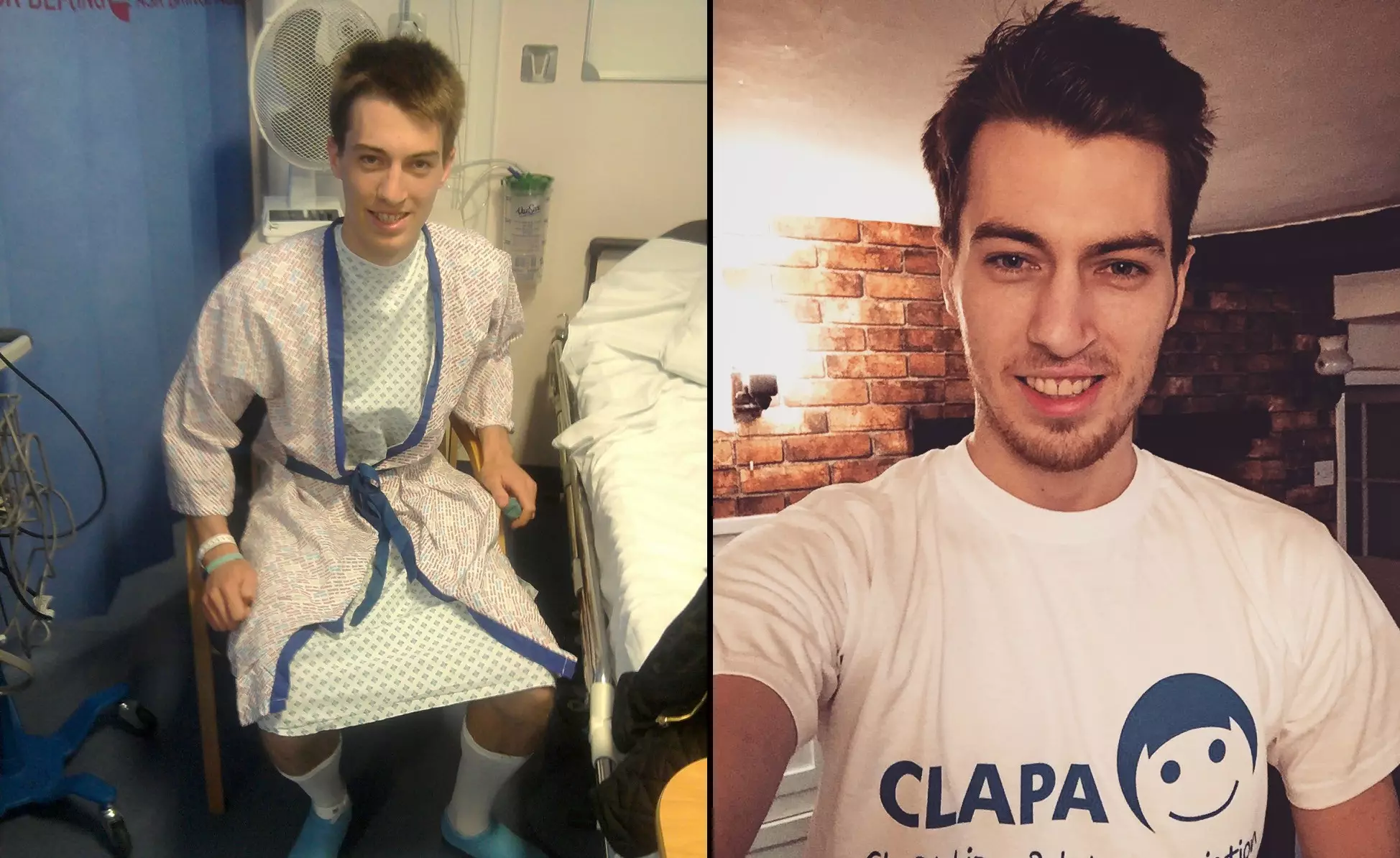 Lad Overcame Cleft Palate And Is Now Raising Thousands For Charity