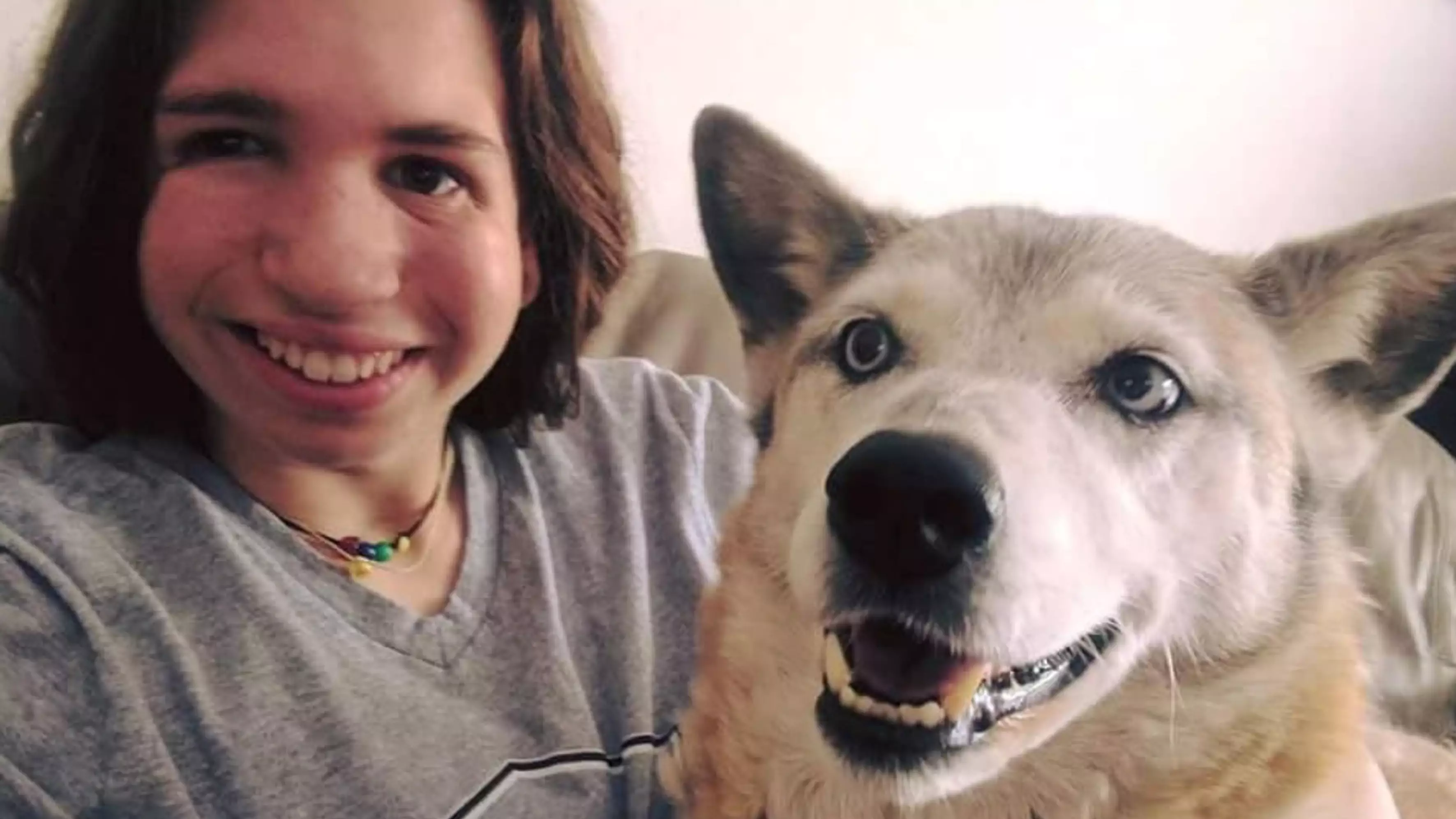 Dog Empowers Teen To Embrace Her Facial Differences And Reject Surgery