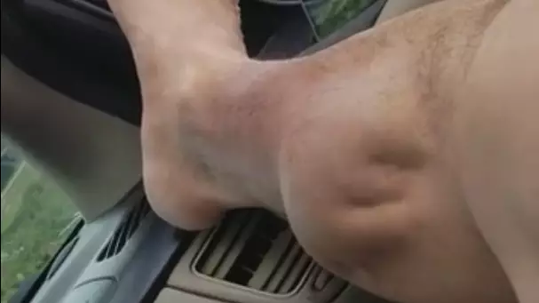 This Guy Has One Of The Most Horrific Looking Calf Cramps Ever 