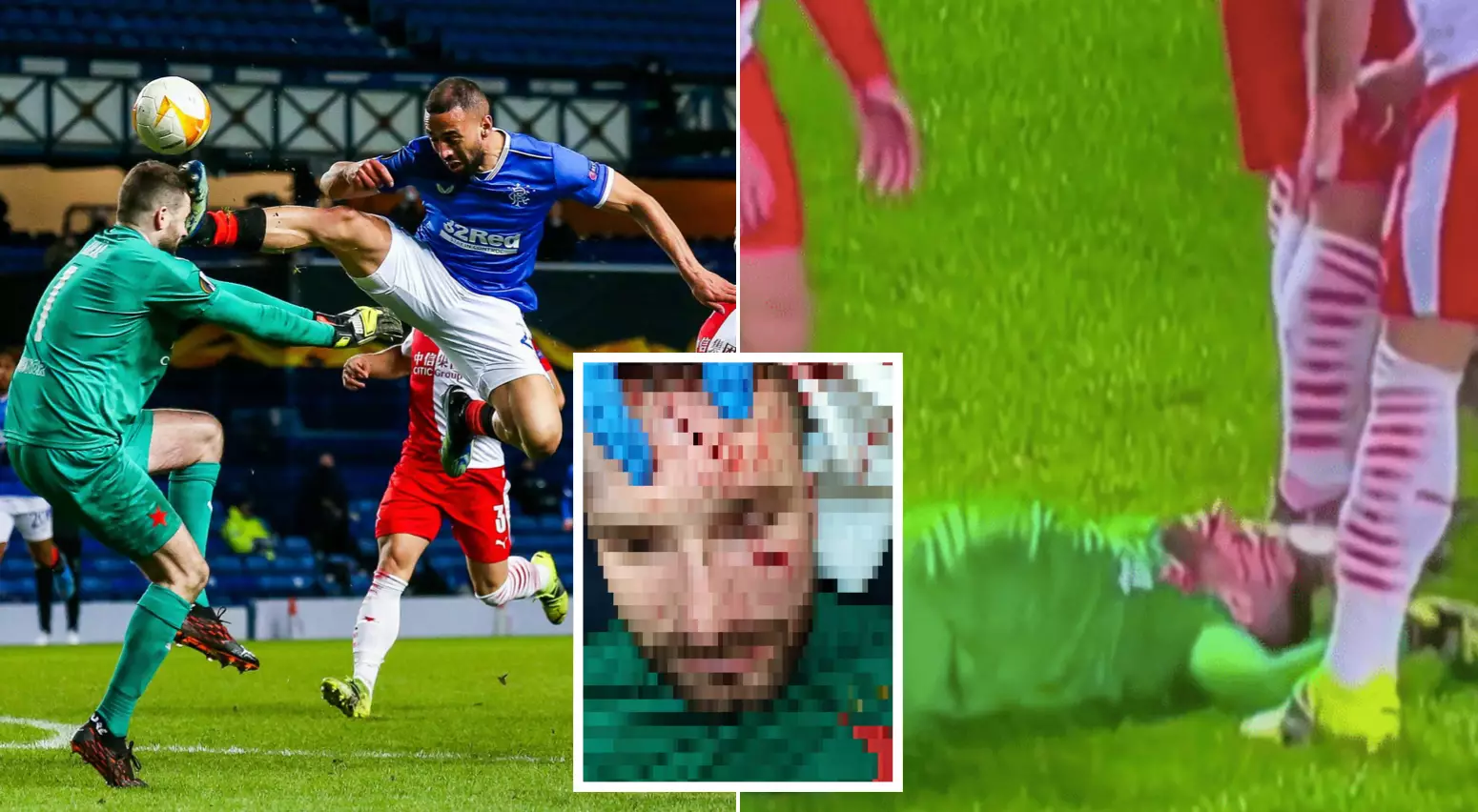 Horrific Photo Of Goalkeeper's Injuries Emerge After Kemar Roofe Head Kick