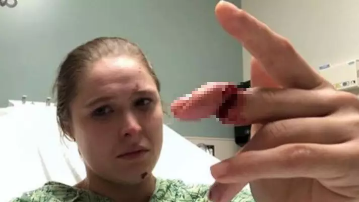 Ronda Rousey Shares Picture Of Gruesome Finger Injury During 9-1-1