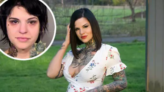 Ex-Drug Addict Turned Her Life Around And Is Now Successful Model Earning £99k-A-Year