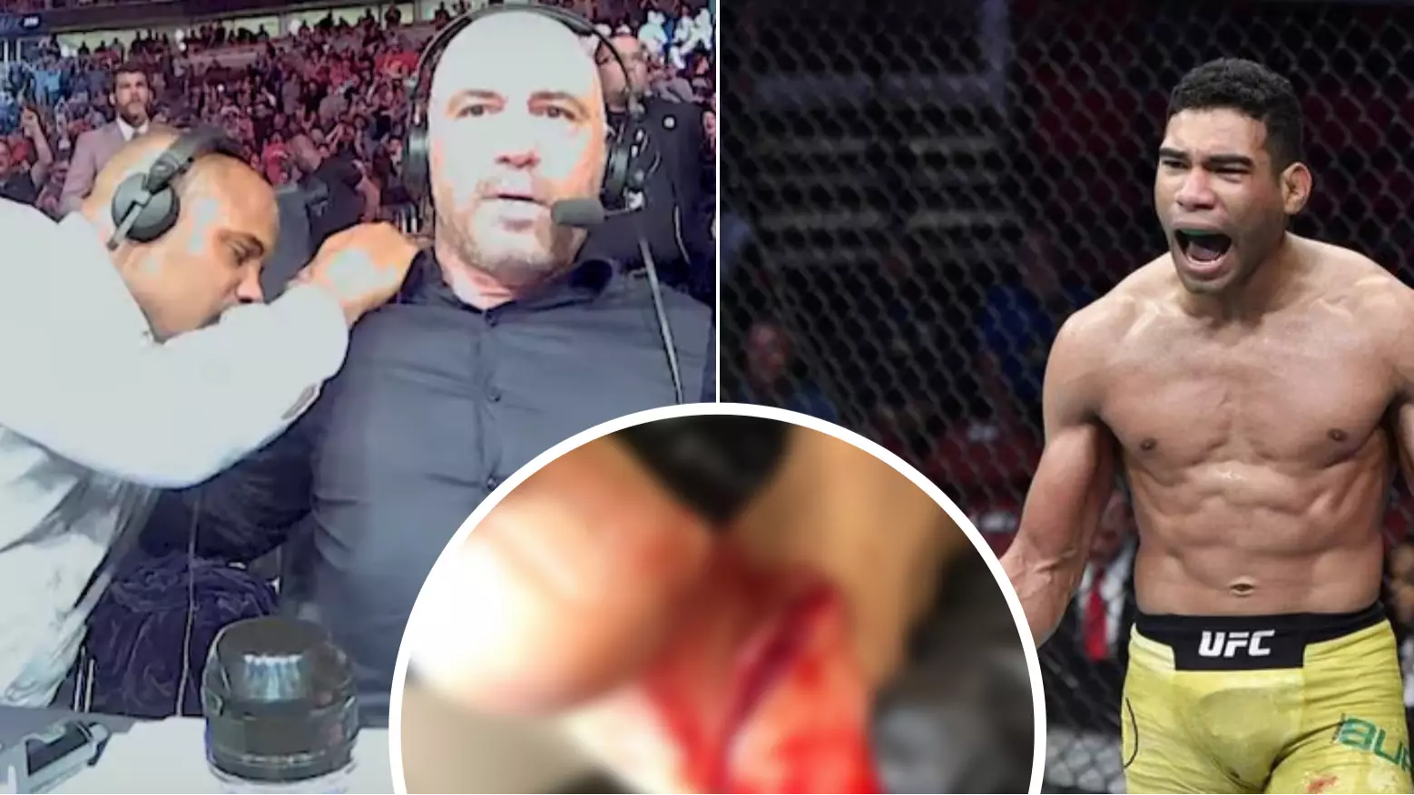 Herbert Burns Suffers Gruesome Foot Injury After Going Through The Cage At UFC 250