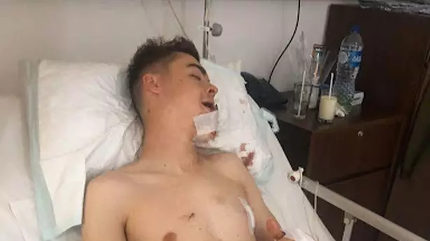 Holidaymaker Involved In Horror Crash Raising Money To Fund His Surgery