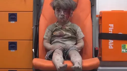 Aleppo Boy Who Became Symbol Of Stricken City Is Much Better Now