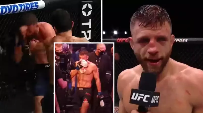 The Brutal Injuries Calvin Kattar Suffered In His Five-Round Beating To Max Holloway