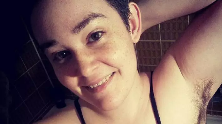Mum With PCOS Shows Off Body Hair To Empower Other Women