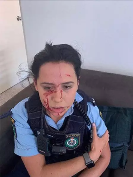 Shocking Images Of NSW Police Officer Battered On Patrol Goes Viral