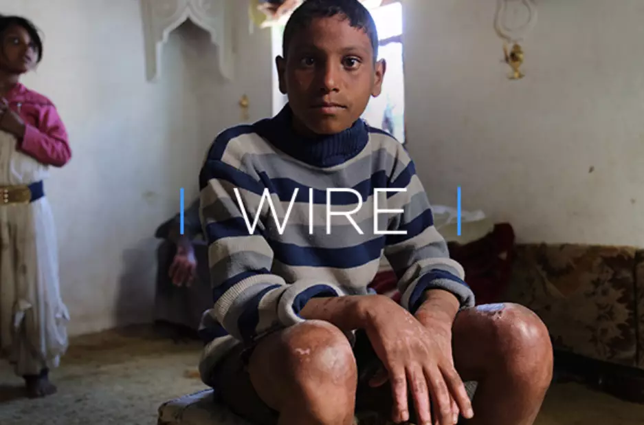 WIRE: The Truth Behind The Humanitarian Crisis In Yemen And The Lives It’s Ruined