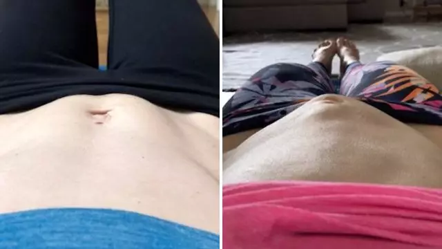 Woman Shares 'Alien'-Style Video Of Guts Popping Out Of Her Stomach