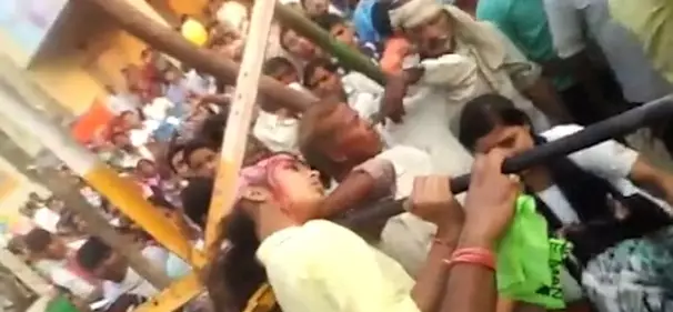 Girl Gets Scalped By A Ferris Wheel When Trying To Take A Selfie
