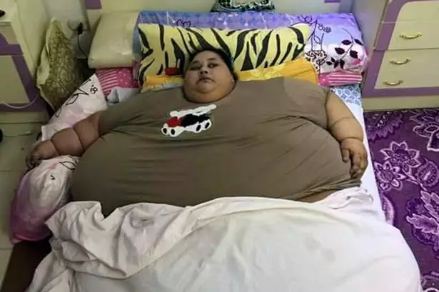 Egyptian Woman Who Weighs 79 Stone Thought Be Heaviest On Earth