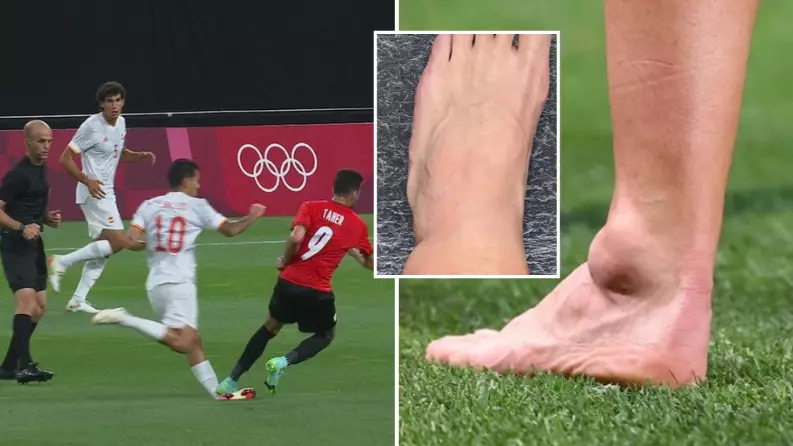 Dani Ceballos Suffers Brutal Ankle Injury After Being Trod On In Olympics Opener