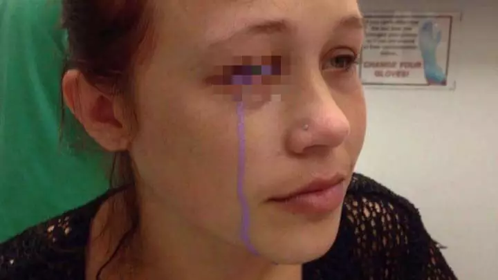 Girl Faces Blindness After 'Massive Mistake' Eye Tattoo Goes Horribly Wrong