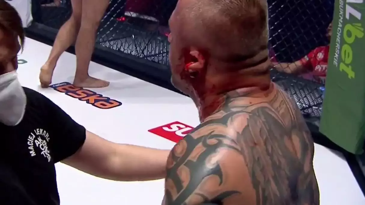 Polish MMA Fighter Lukasz Borowski's Ear Ripped Off During Bout