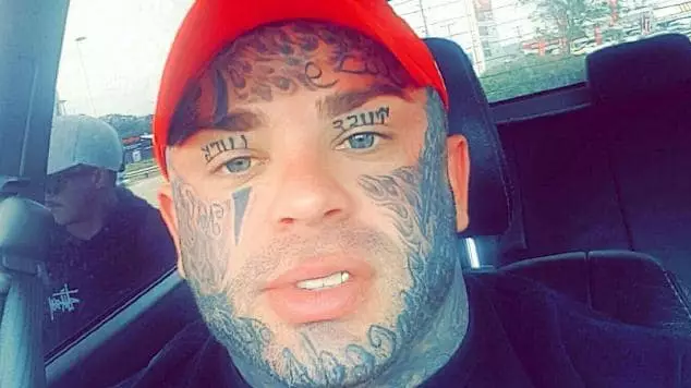 Aussie Bikie Wants His Face Tattoos Removed Because He Reckons They’re Embarrassing 