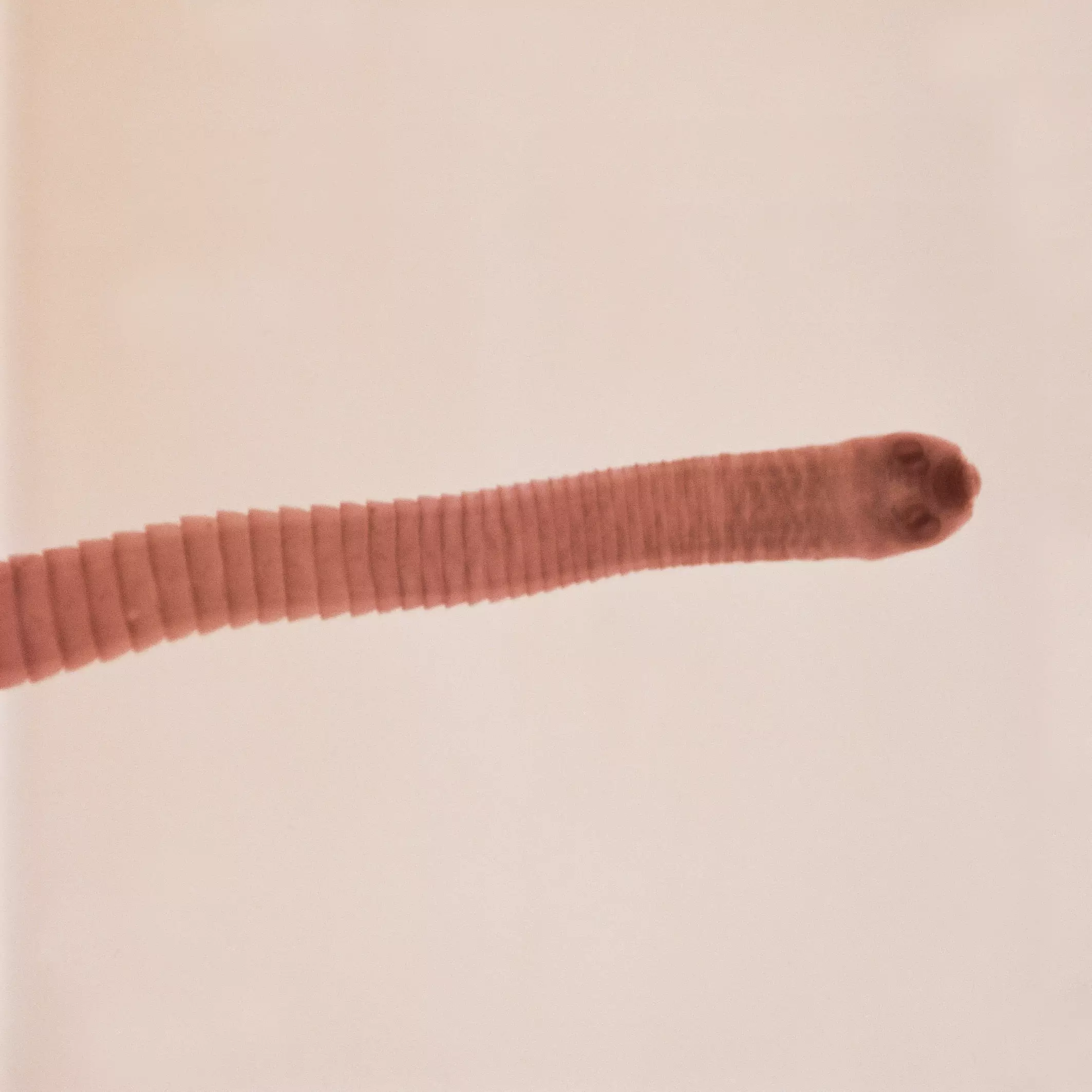 A close up of a tapeworm.