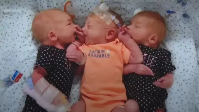 Woman Rushed To Hospital With Suspected Kidney Stones Gives Birth To Triplets