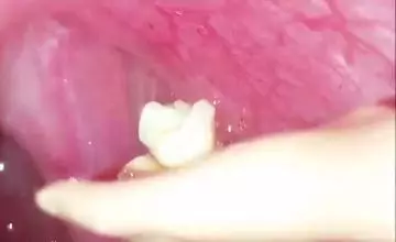 Gross Individual Uses Barbie To Extract Weird Shit From Mouth