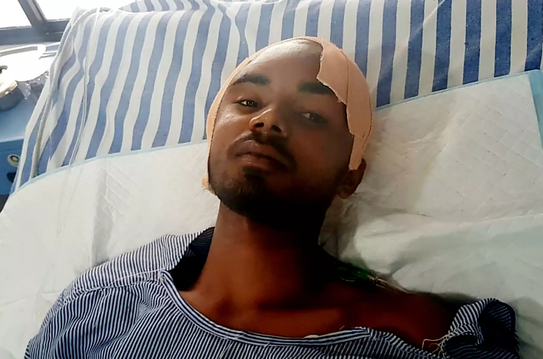 Sanjay Bahe after his surgery.
