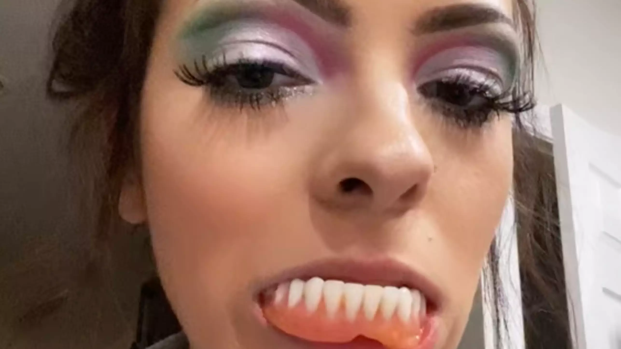 Woman, 24, Forced To Wear Dentures Following Botched Root Canal Treatment