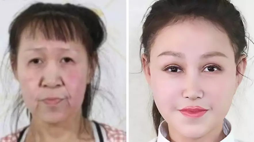 15-Year-Old Girl Who 'Looked Like She Was 60' Given New Face After Strangers Cover Medical Costs