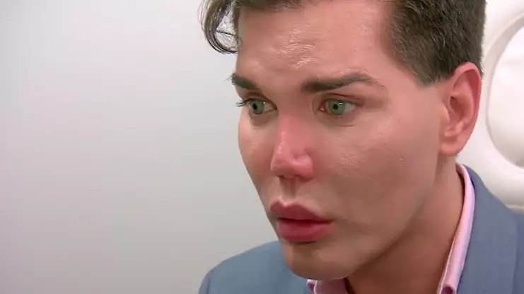 Doctor Warns 'Human Ken Doll' His Nose Could Fall Off 