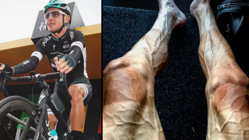 Tour De France Cyclist Shared Shocking Photo Of His Legs 