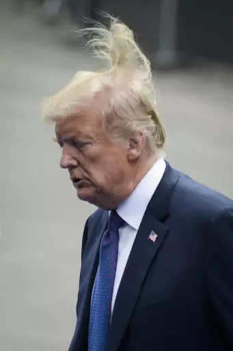 Wolff says the president's hair is the result of dye, spray and scalp reduction surgery.