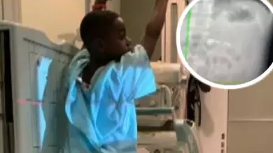 Seven-Year-Old Boy Rushed To Hospital After Swallowing Apple AirPod He Got For Christmas