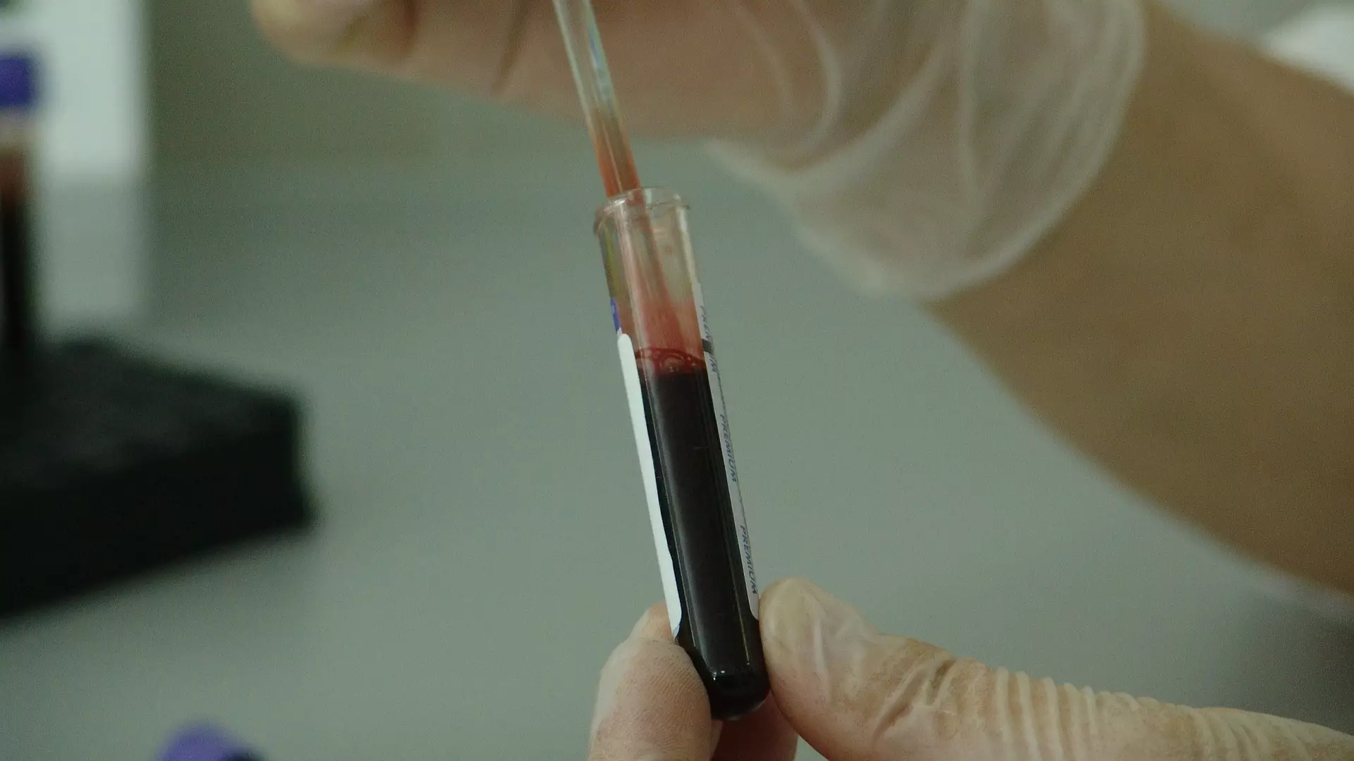 Scientists Develop Blood Test That Can Predict When You Will Die