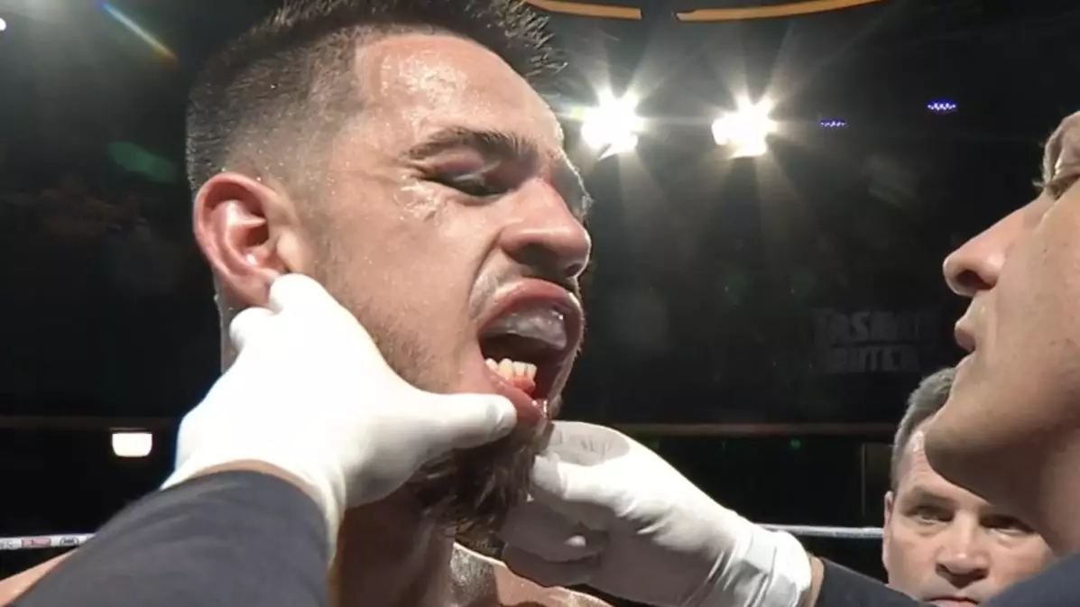 Aussie Boxer Benjamin Hussain Fights For Five Rounds With 'Worst Broken Jaw We've Ever Seen'