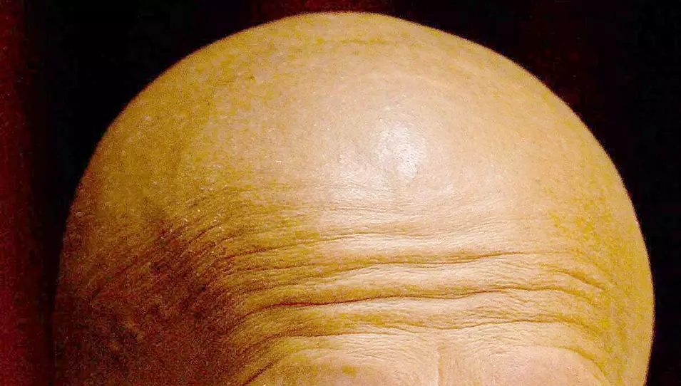 A bald man. Yeah, no shit.