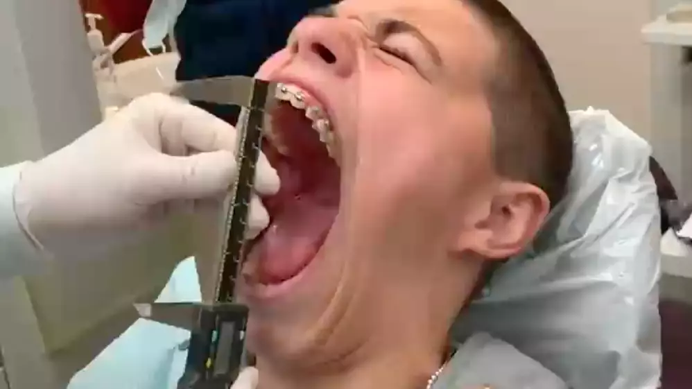 Teen Reclaims The Guinness World Record For The Widest Gaping Mouth 