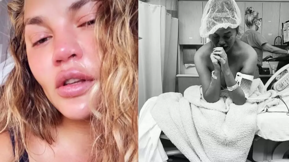 Chrissy Teigen Breaks Down In Tears During Therapy Three Months After Loss Of Baby Jack